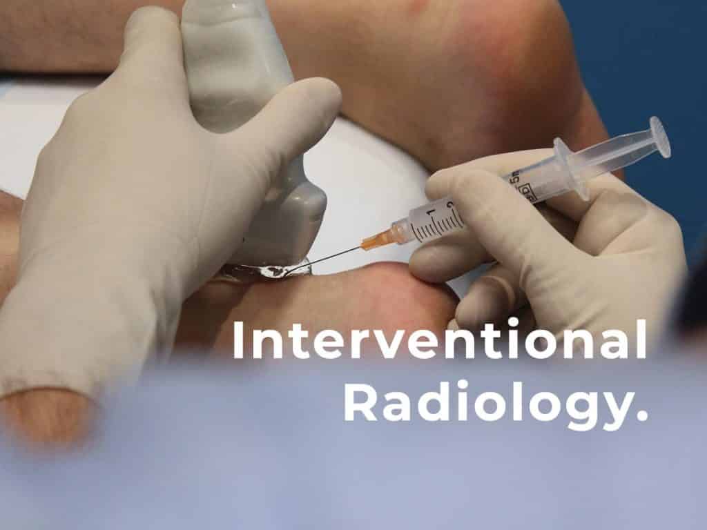 Interventional Radiology Services available at Melbourne Radiology Clinic