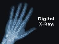digital x-ray of a hand
