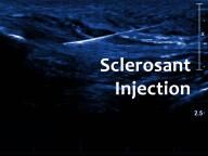 Sclerosant-Injection - Melbourne Radiology
