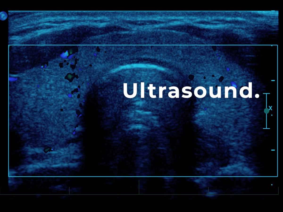sample ultrasound imaging