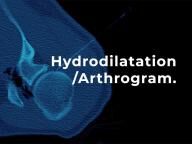medical image with the words hydrodilatation / arthrogram on it