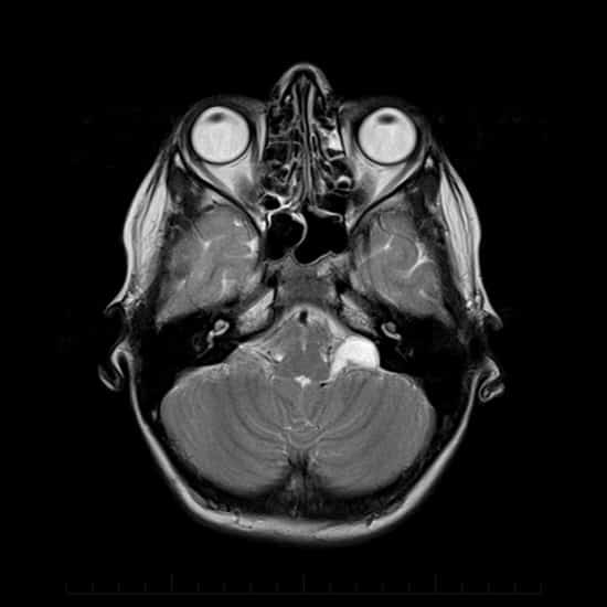 brain MRI top view
