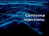 Cortisone Injections