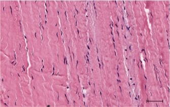 Figure 1 A. Microscopic slide showing normal tenocytes (blue ovoid spindle shape cells) surrounded by strands of dense collagen fibres which provide a tendon with its tensile strength.